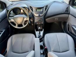 HYUNDAI - HB20 - 2015/2015 - Branca - R$ 57.900,00